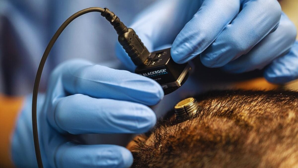 Mientras medio mundo sigue hipnotizado con la inteligencia artificial, China está empujando otra tecnología todavía más inquietante… La de los chips implantados directamente en el cerebro