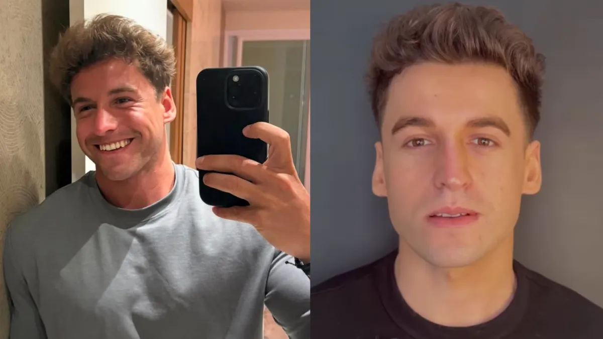 Manuel Ibero, ex participante de Gran Hermano, se sometió a unos retoques estéticos: que se hizo