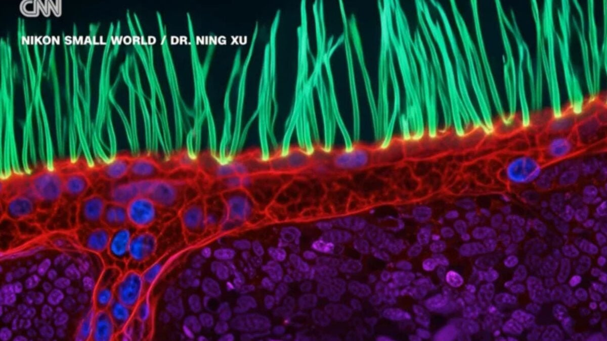 ¿Hubo trampa? El video de microscopio que ganó un concurso está lleno de elementos de IA